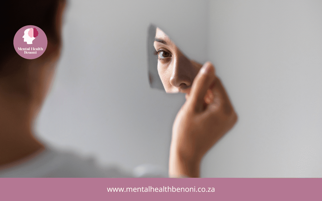 Emotional support in Benoni